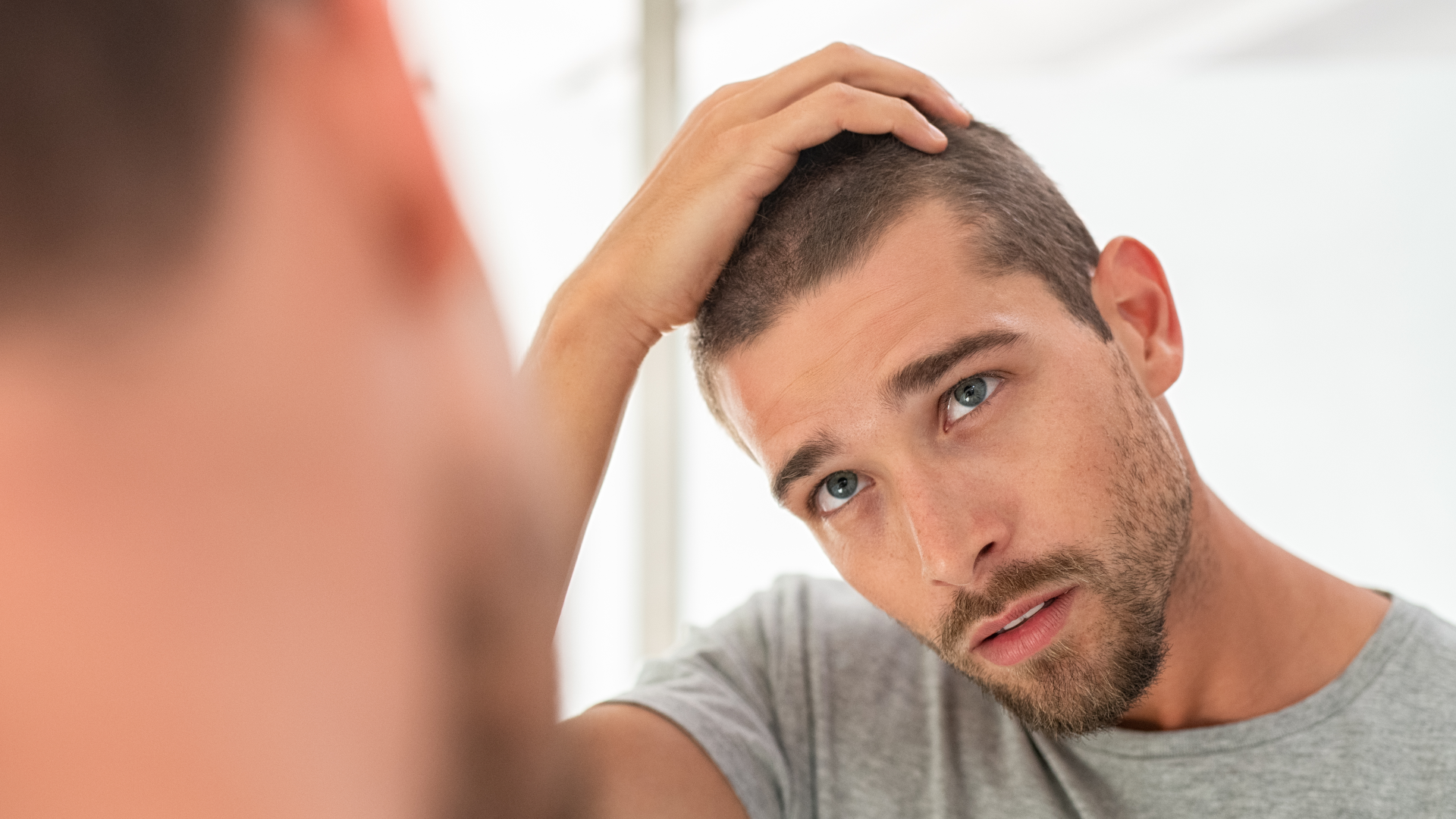 Do Steroids Cause Hair Loss?