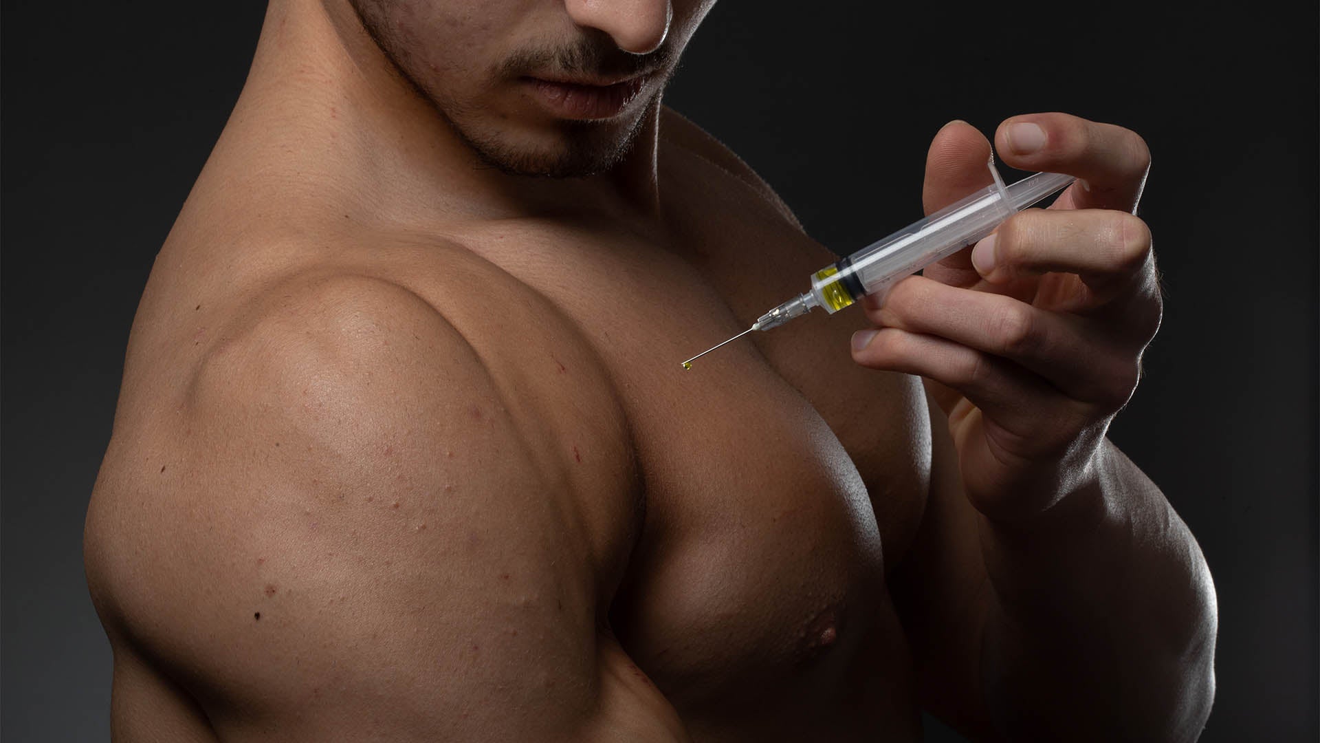What are anabolic steroids